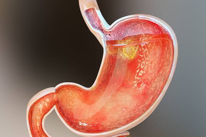 SUCS GASTRIQUES